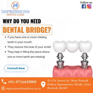 Best Dentist Near Me In Noida At Impressions Dental Care 