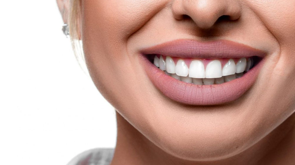 hollywood smile dental clinic