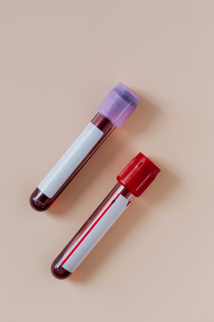 Blood Tests for Body Analysis in Dubai