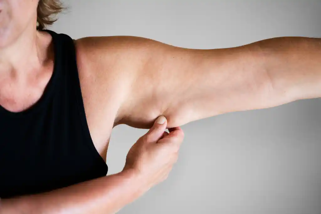 Arm lift surgery in Dubai