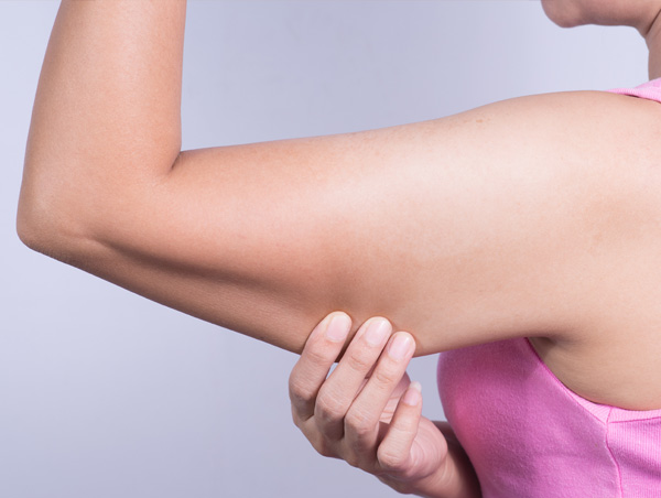 Arm lift surgery in Dubai