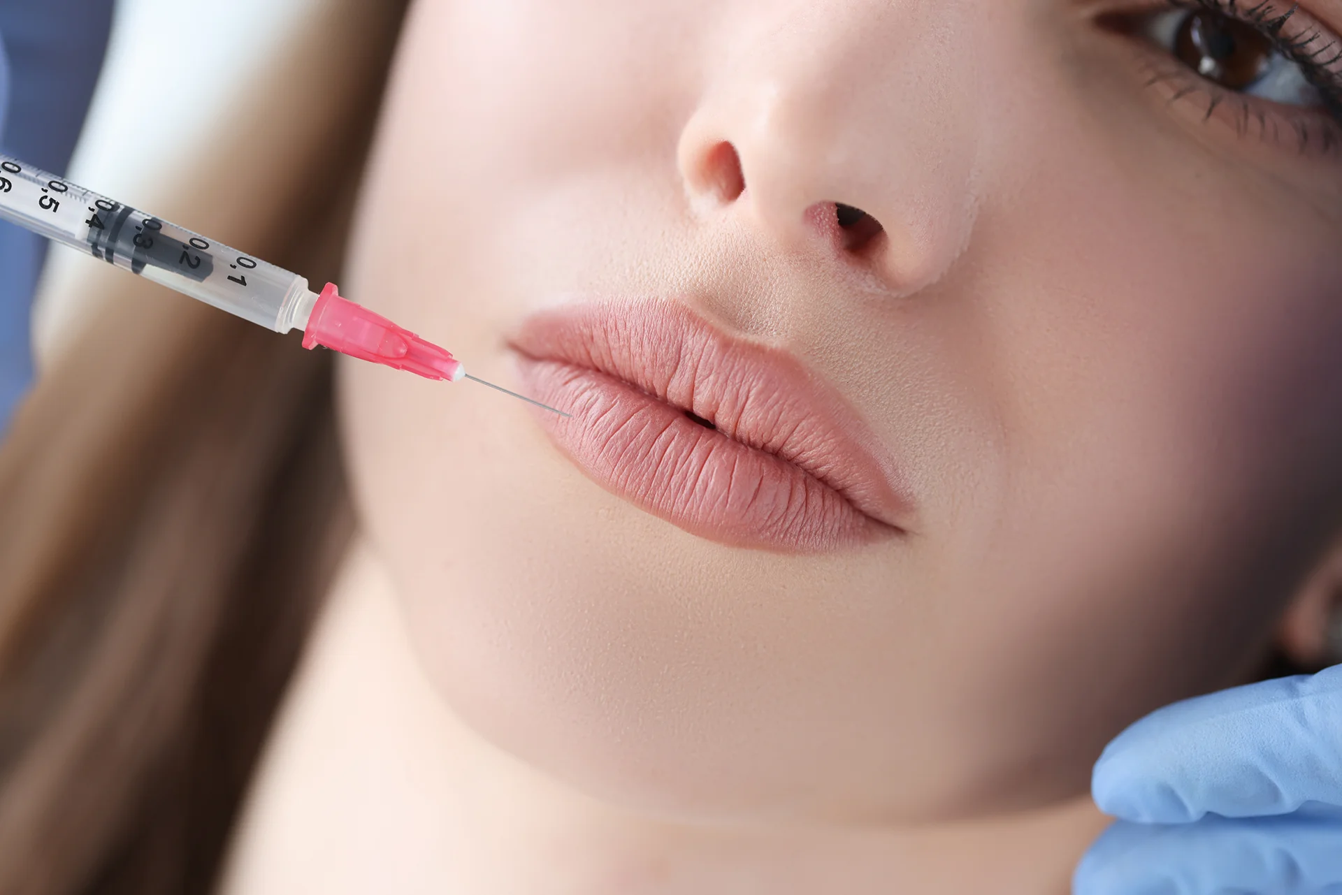 How Quick Are Russian Lip Fillers Treatment Sessions