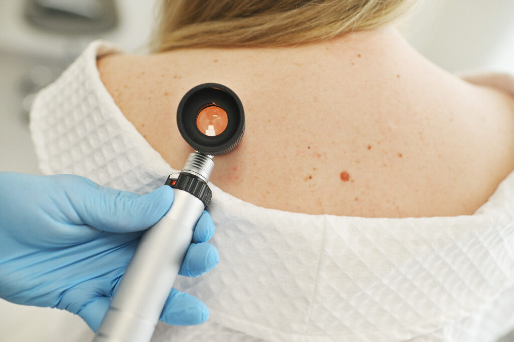 Does a Dermatologist Diagnose Skin Growths?