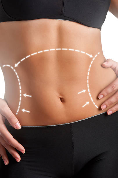 Body Sculpting in Riyadh