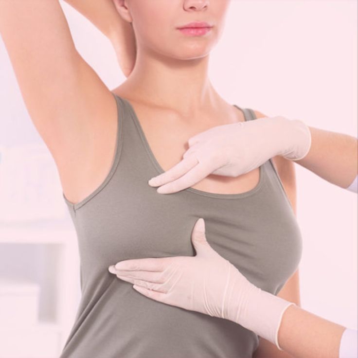 Breast Cysts Treatement in Riyadh