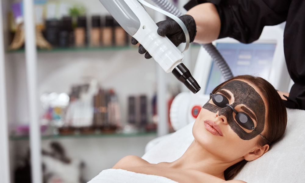Carbon Laser Peel Facial
