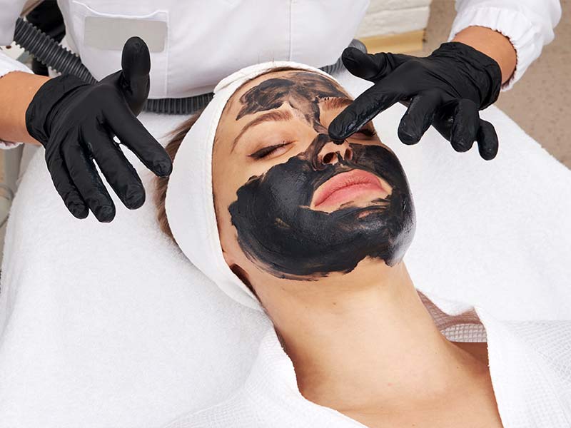 Carbon Laser Peel Facial in Dubai