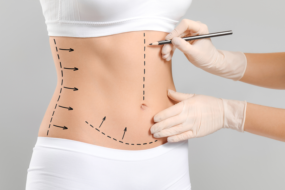 Is Lipotropic Injections a Permanent Solution