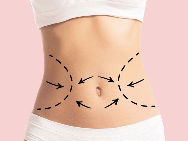 Obesity Surgery in Riyadh
