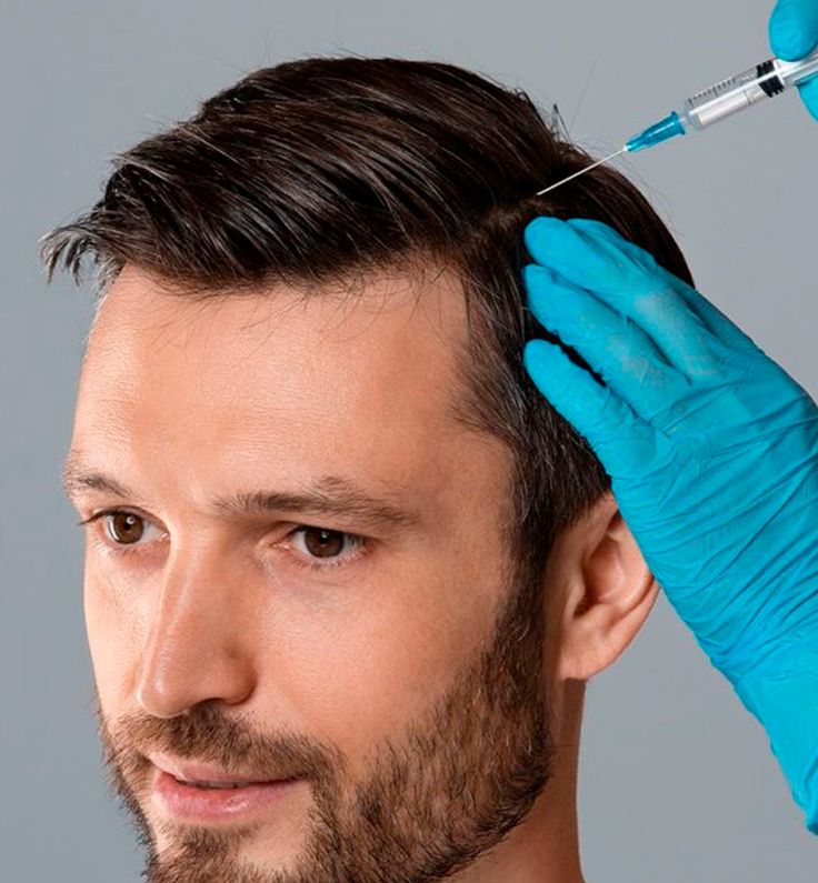 PRP Hair Treatment in Riyadh