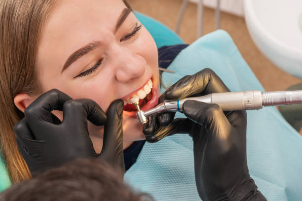 Teeth Cleaning and Polishing