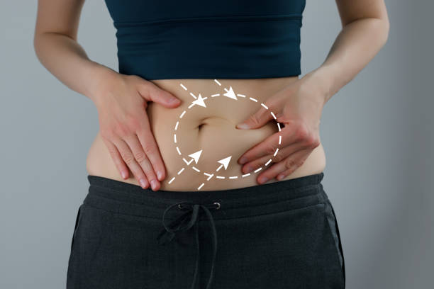 Tummy Tuck in Riyadh