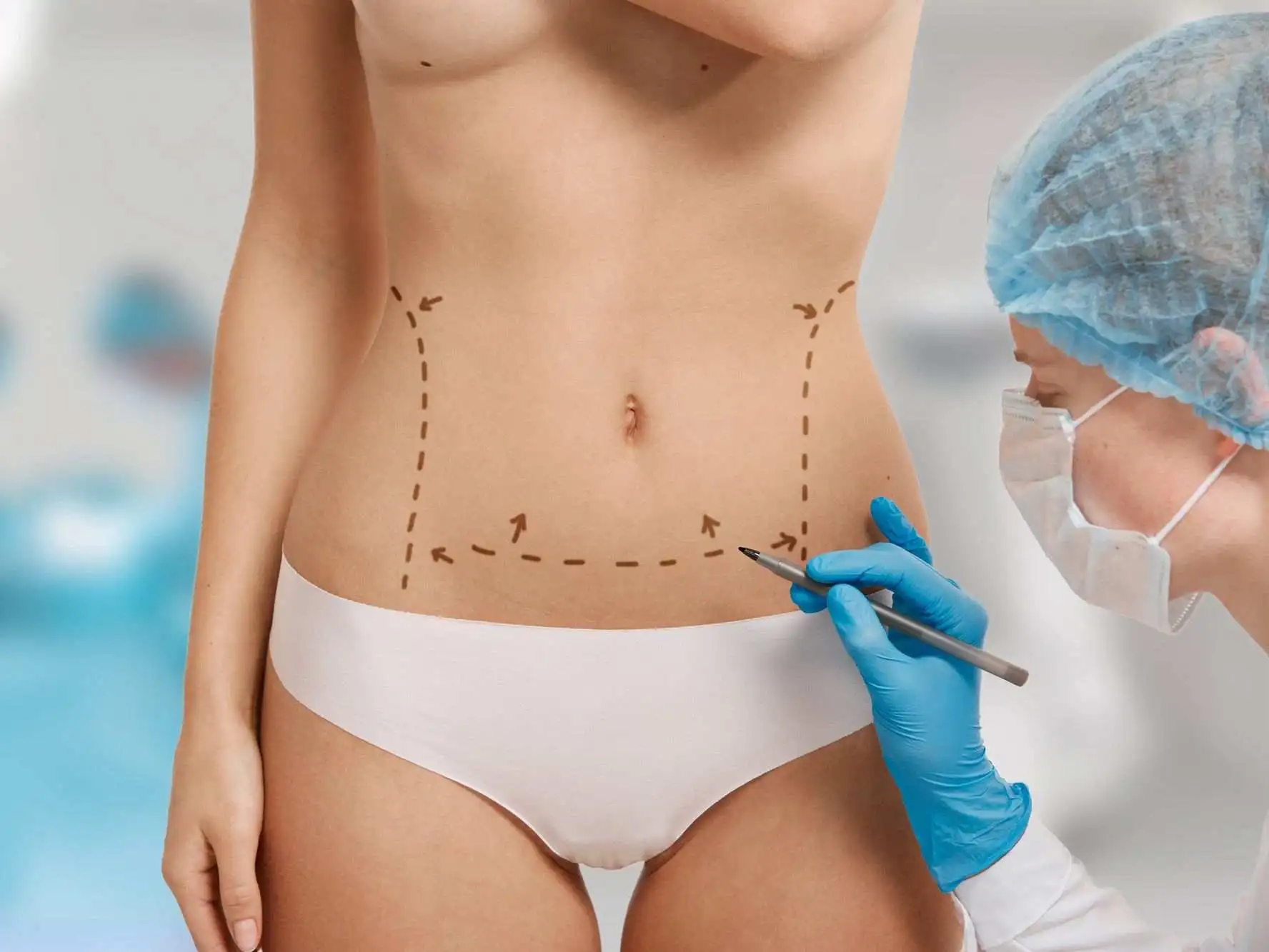 vaser 4D liposuction in dubai