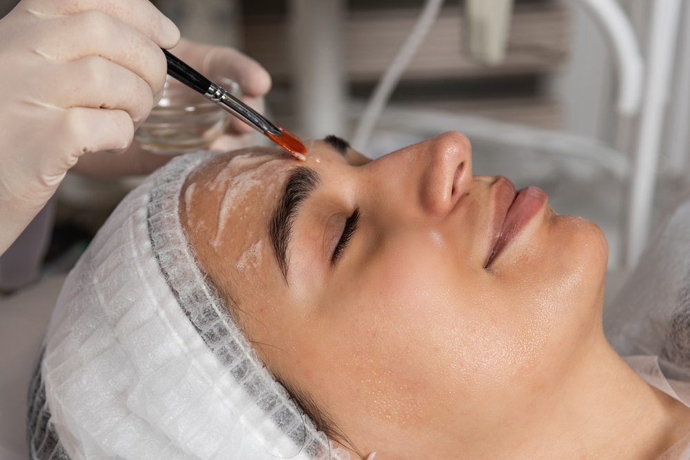 Chemical Peels Cost in Dubai