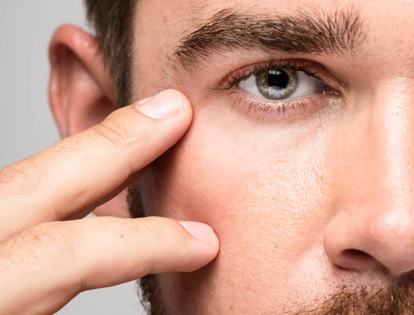 Eyelid Surgery in Dubai