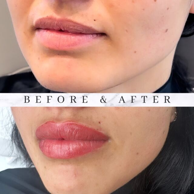 skin clinic richmond