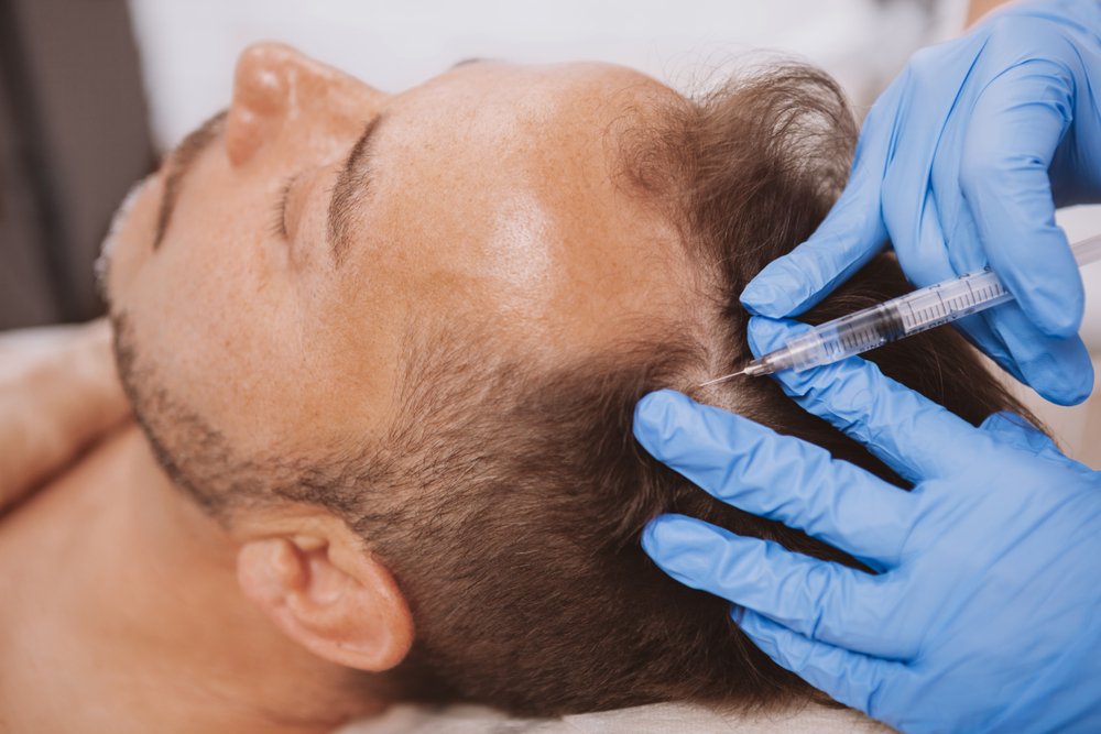 Hair Specialist Doctor in Dubai
