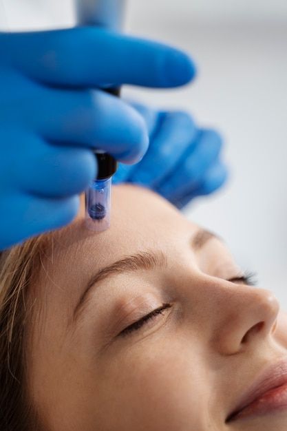 Derma Pen