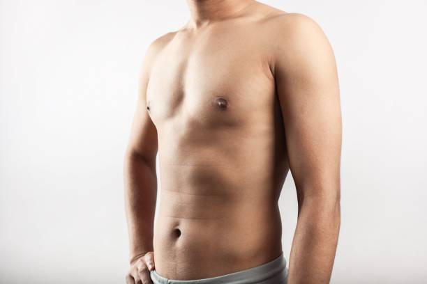 Gynecomastia Surgery in Riyadh
