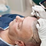 Hair Transplant in Dubai Is Confidence on Demand