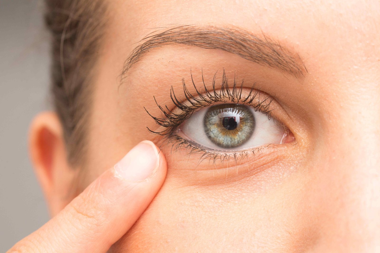 Under Eye Fillers in Dubai