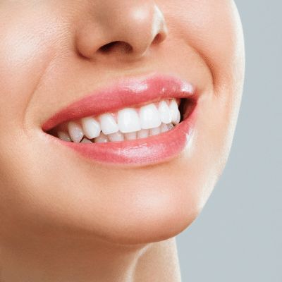 Teeth Stain Removal Riyadh Experts