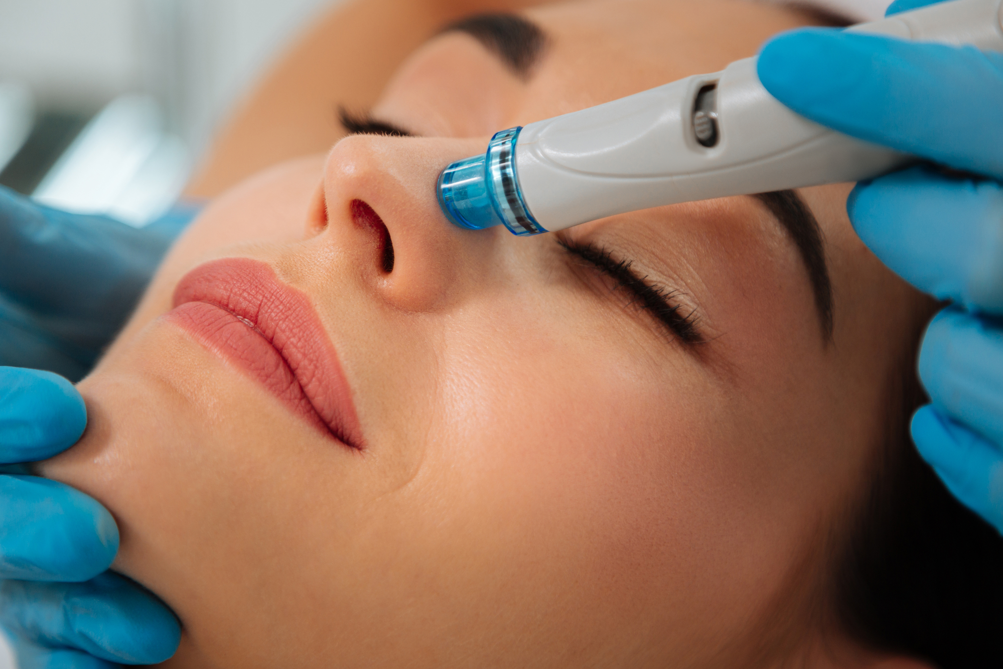 What Is a HydraFacial and How Does It Work?