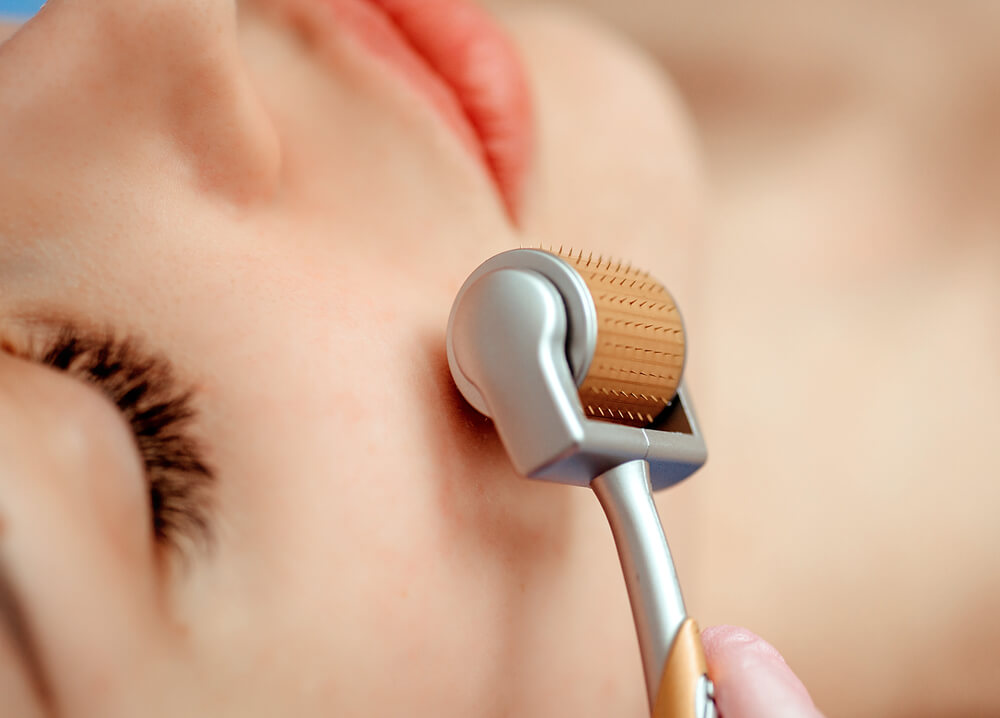 What Size Derma Roller Is Best For Face