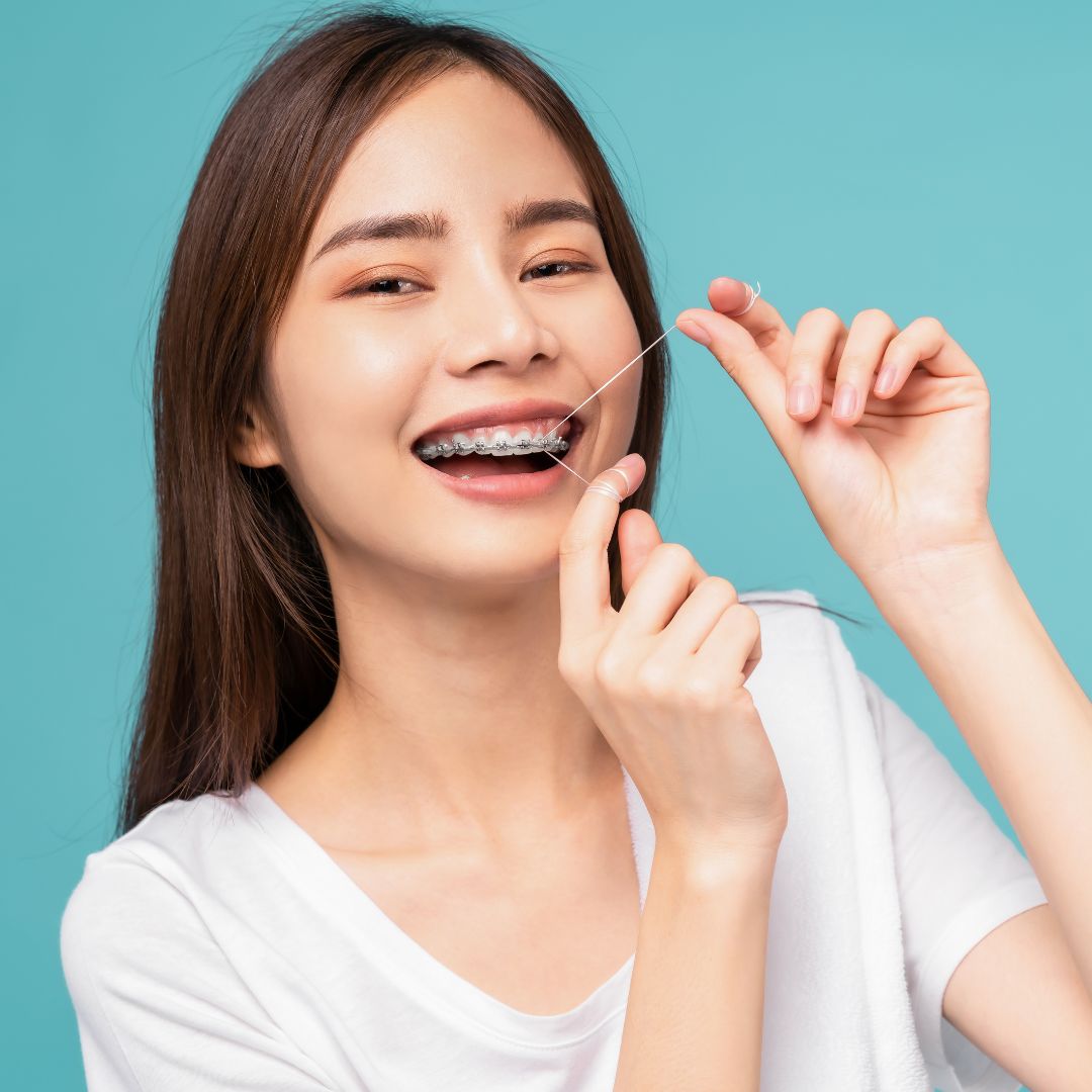 how much are braces