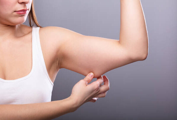 Can Ultrasound Cavitation Treat Arm Fat?