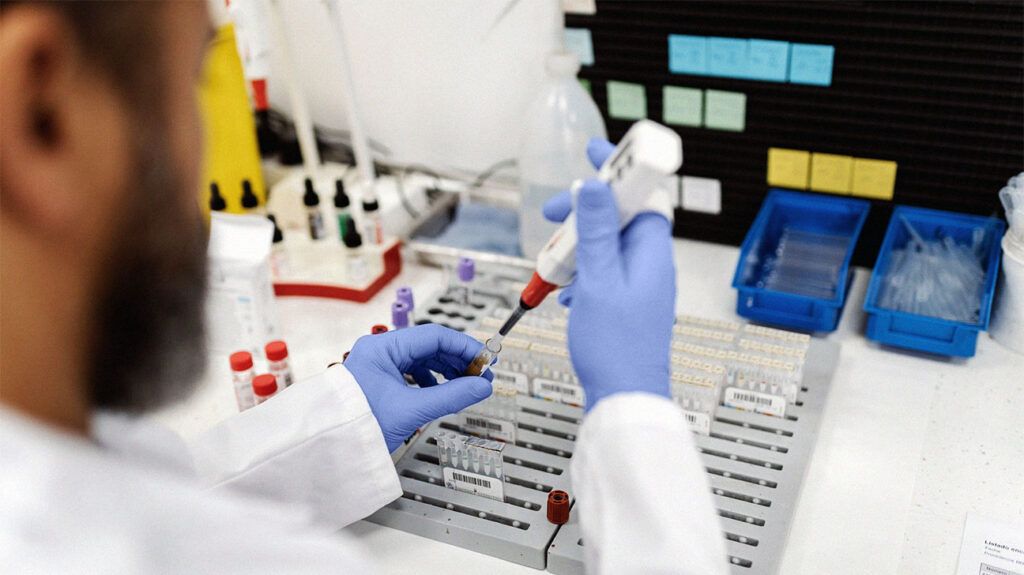 Blood Test at Home for NAD+ Levels: The Longevity Connection