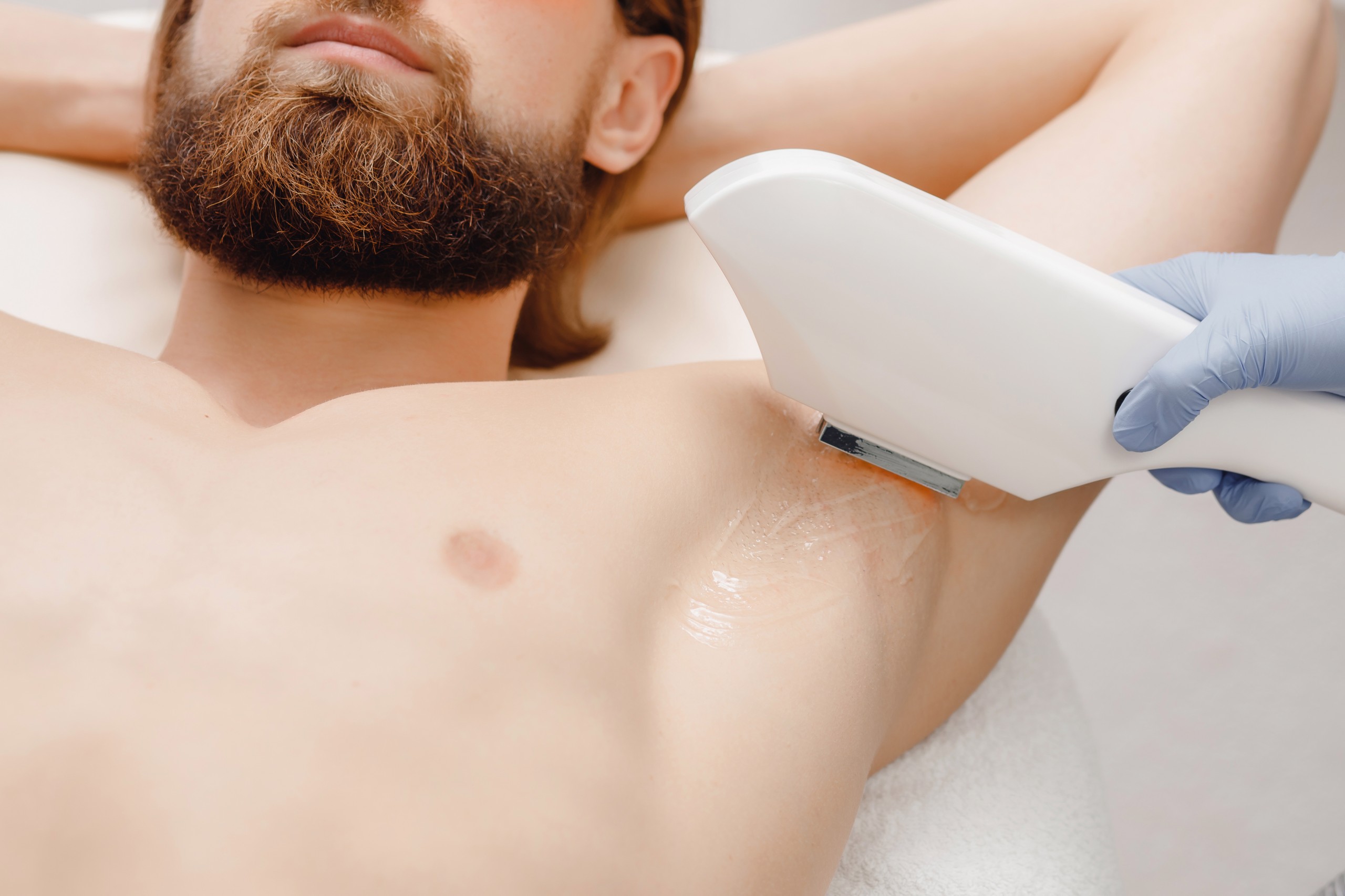 Best Laser Hair Removal Benefits You Didn’t Know You Needed