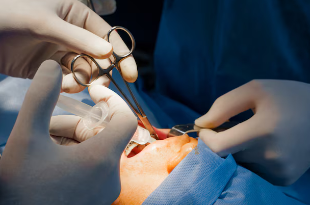 tooth extraction knightdale nc