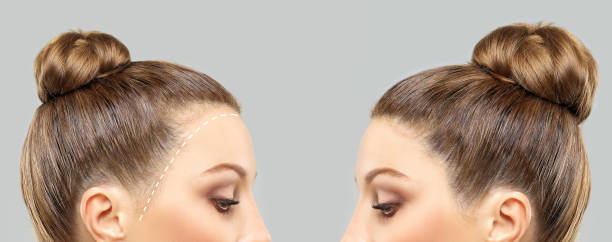 تجميل الأنف في الرياض بأحدث التقنيات وأفضل الأطباء