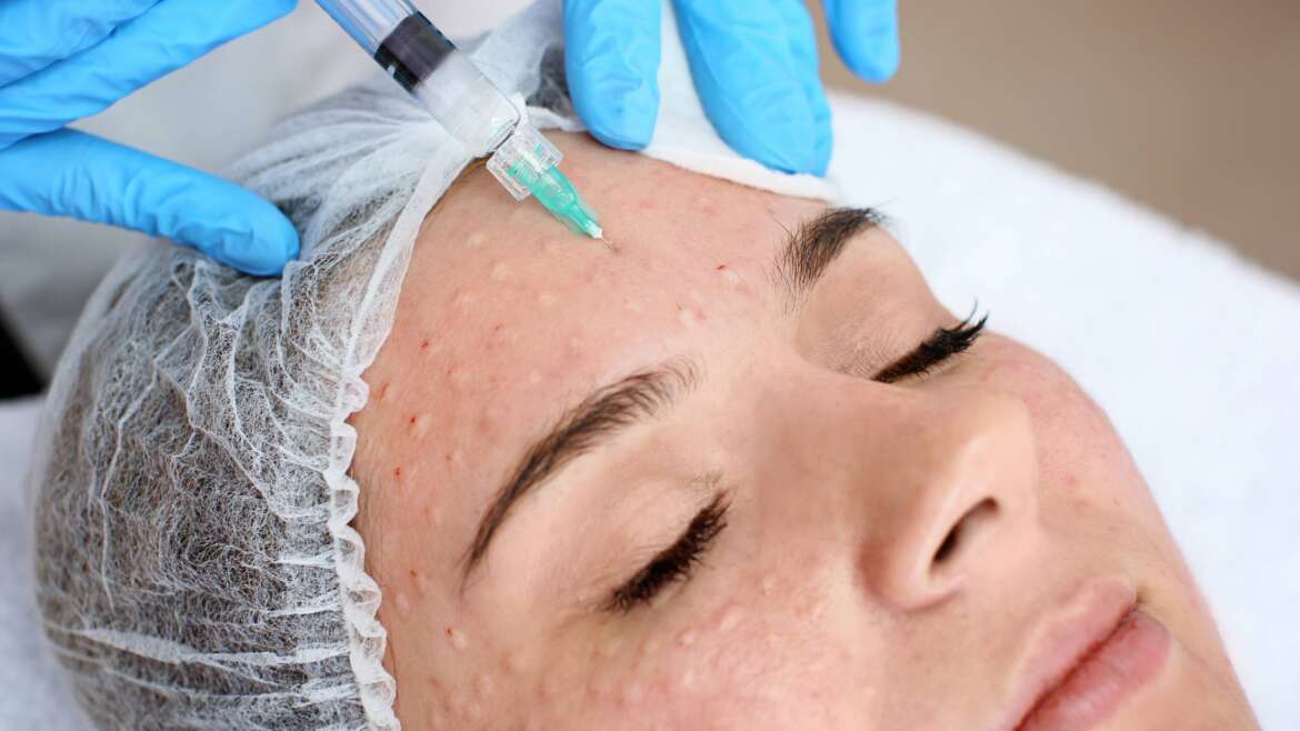 Bio Revitalization Treatment in Dubai