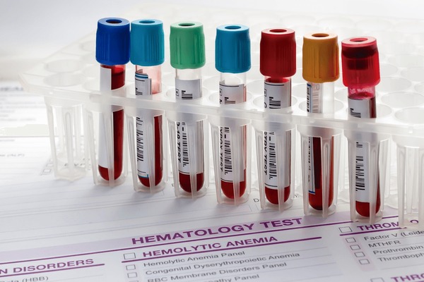 Blood Test at Home: Understanding Your Complete Blood Count (CBC)