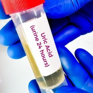 What are High and Low Uric Acid Levels in the Body