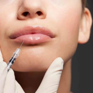 lip fillers in islamabad