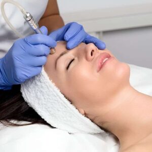 microdermabrasion in islamabad