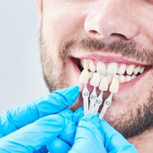 Benefits of Dental Veneers for a Confident Smile